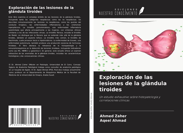 Produktbild: Exploraci&oacute;n de las lesiones de la gl&aacute;ndula tiroides