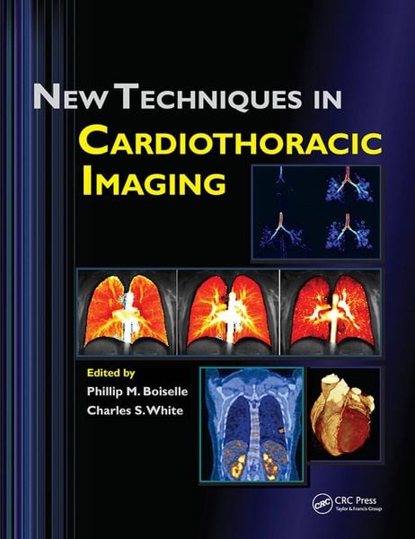 Produktbild: New Techniques in Cardiothoracic Imaging