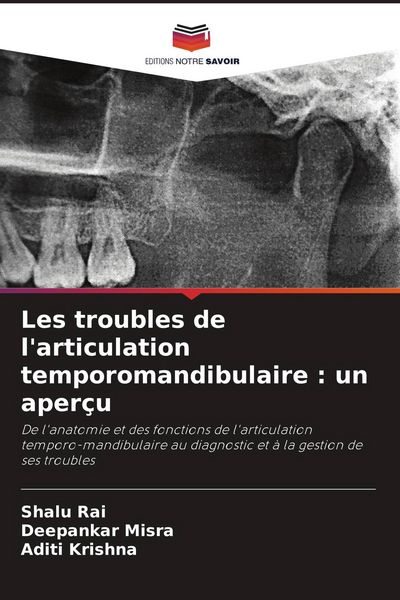 Produktbild: Les troubles de l'articulation temporomandibulaire : un aper&ccedil;u