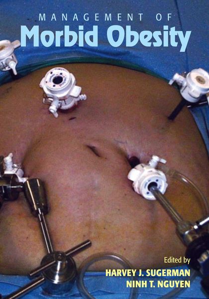 Produktbild: Management of Morbid Obesity