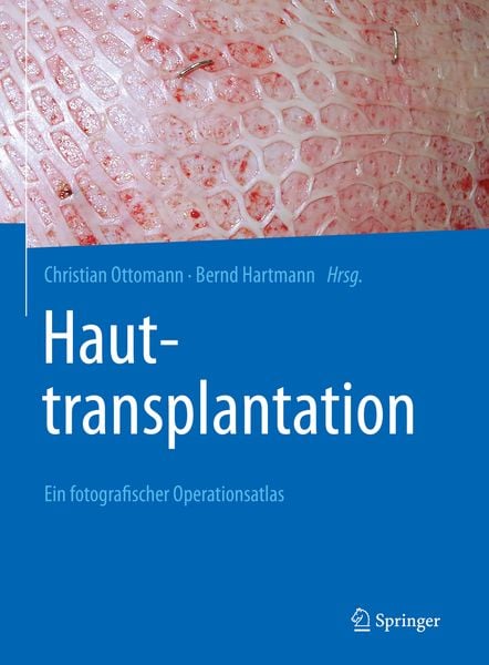 Produktbild: Hauttransplantation