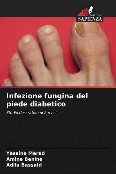 Produktbild: Infezione fungina del piede diabetico