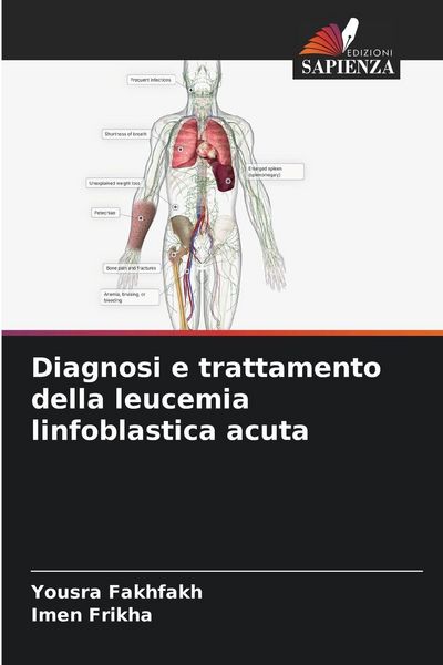 Produktbild: Diagnosi e trattamento della leucemia linfoblastica acuta