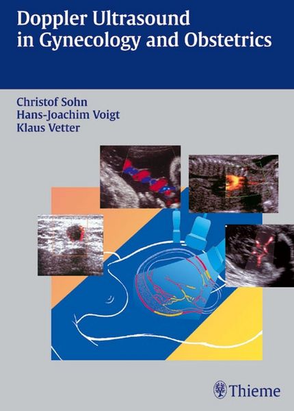 Produktbild: Doppler Ultrasound in Gynecology and Obstetrics