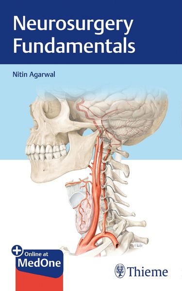 Produktbild: Neurosurgery Fundamentals