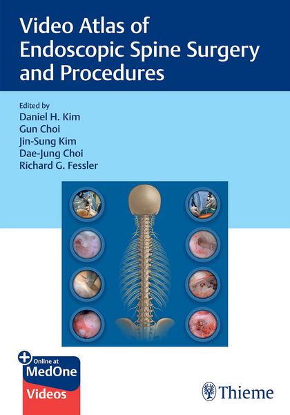 Produktbild: Video Atlas of Endoscopic Spine Surgery and Procedures