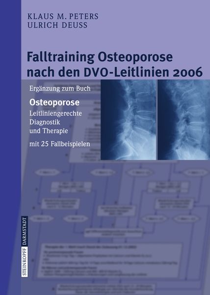 Falltraining Osteoporose nach den DVO-Leitlinien 2006, Taschenbuch von Klaus M. Peters , Ulrich Deuss, Steinkopff, 9783798516571