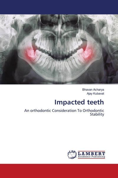 Produktbild: Impacted teeth