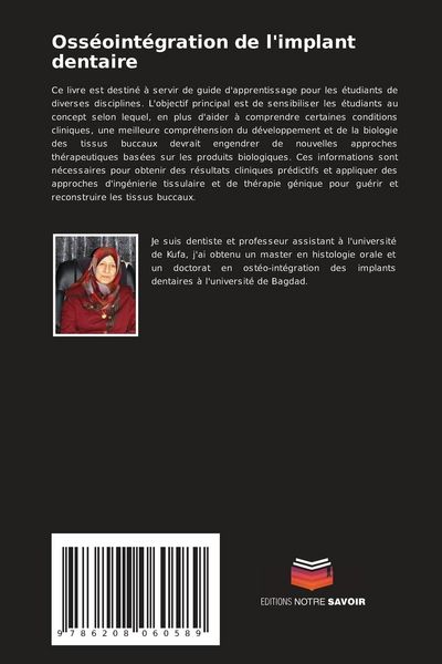 Produktbild: Oss&eacute;oint&eacute;gration de l'implant dentaire