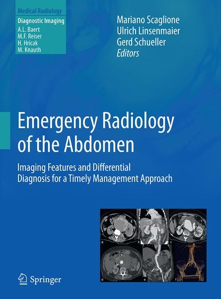Produktbild: Emergency Radiology of the Abdomen