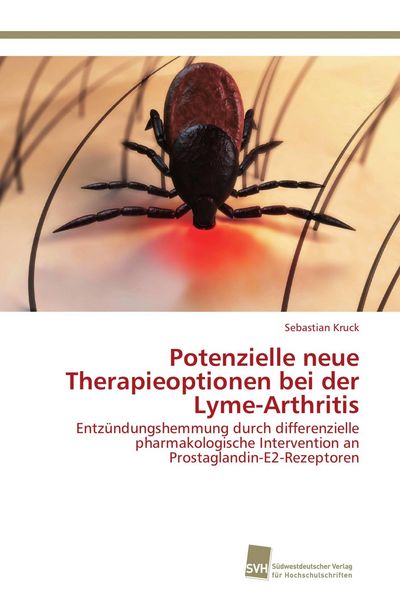 Produktbild: Potenzielle neue Therapieoptionen bei der Lyme-Arthritis