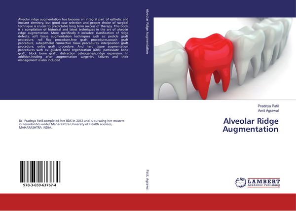 Produktbild: Alveolar Ridge Augmentation