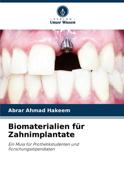 Produktbild: Biomaterialien f&uuml;r Zahnimplantate