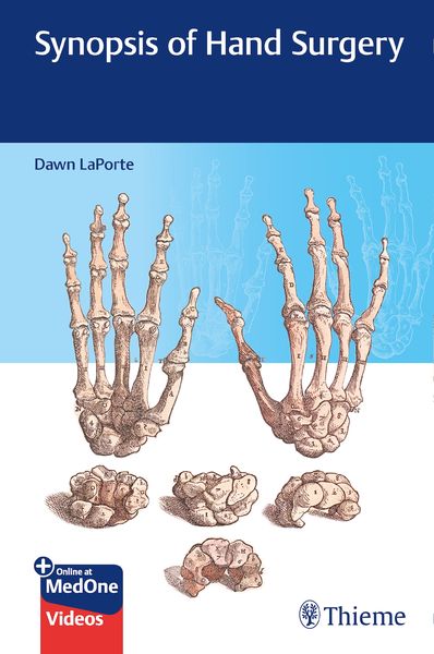 Produktbild: Synopsis of Hand Surgery