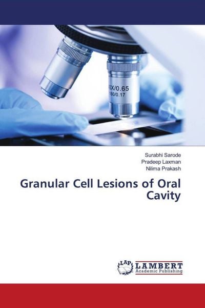 Produktbild: Granular Cell Lesions of Oral Cavity