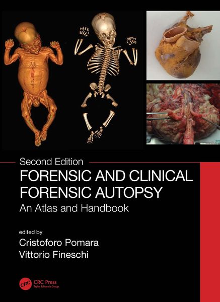 Produktbild: Forensic and Clinical Forensic Autopsy