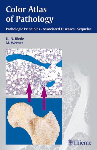 Produktbild: Color Atlas of Pathology