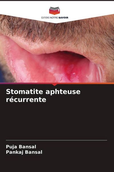 Produktbild: Stomatite aphteuse r&eacute;currente