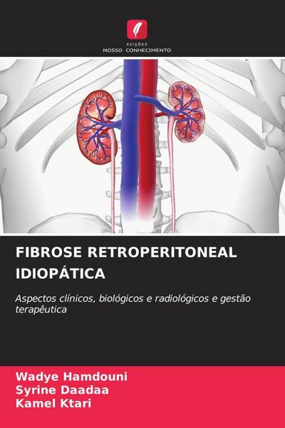 Produktbild: Fibrose Retroperitoneal Idiop&aacute;tica