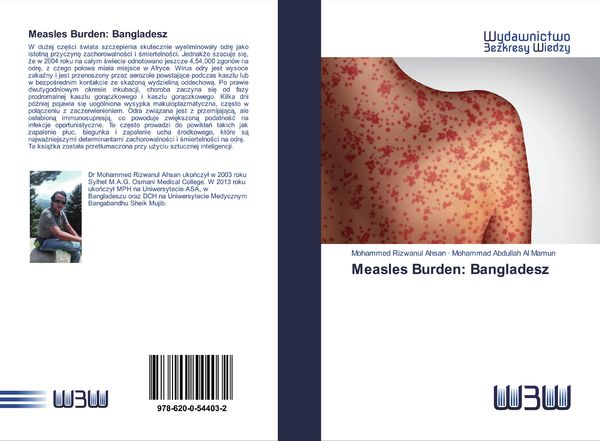 Produktbild: Measles Burden: Bangladesz