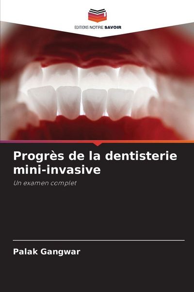 Produktbild: Progr&egrave;s de la dentisterie mini-invasive