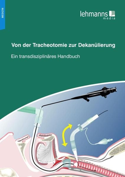 Produktbild: Von der Tracheotomie zur Dekan&uuml;lierung