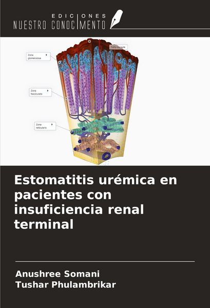 Produktbild: Estomatitis ur&eacute;mica en pacientes con insuficiencia renal terminal