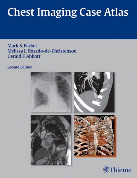 Produktbild: Chest Imaging Case Atlas