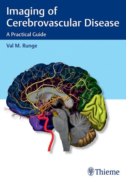 Produktbild: Imaging of Cerebrovascular Disease