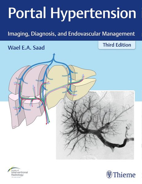 Produktbild: Portal Hypertension