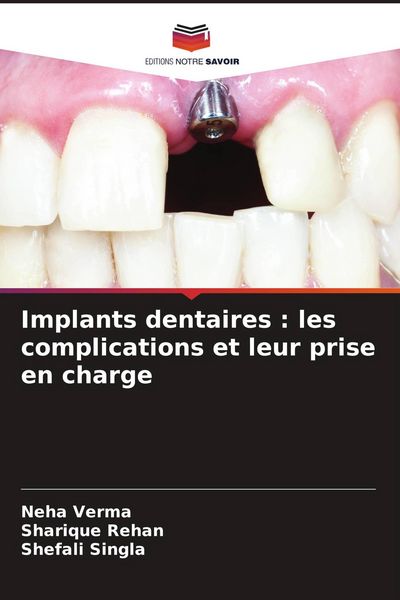 Produktbild: Implants dentaires : les complications et leur prise en charge