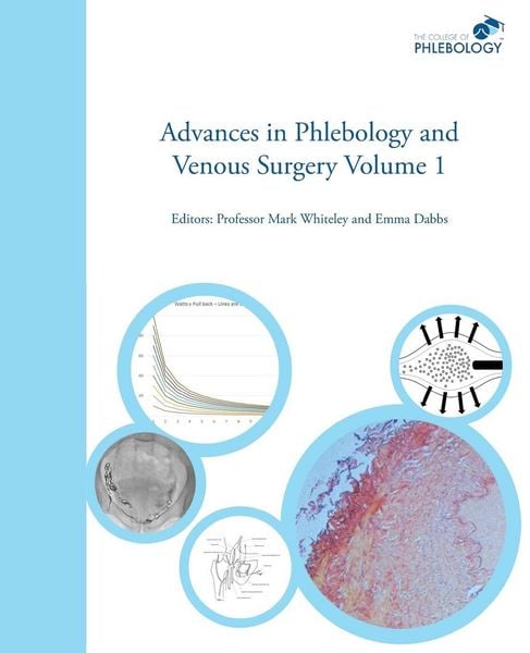 Produktbild: Advances in Phlebology and Venous Surgery Volume 1