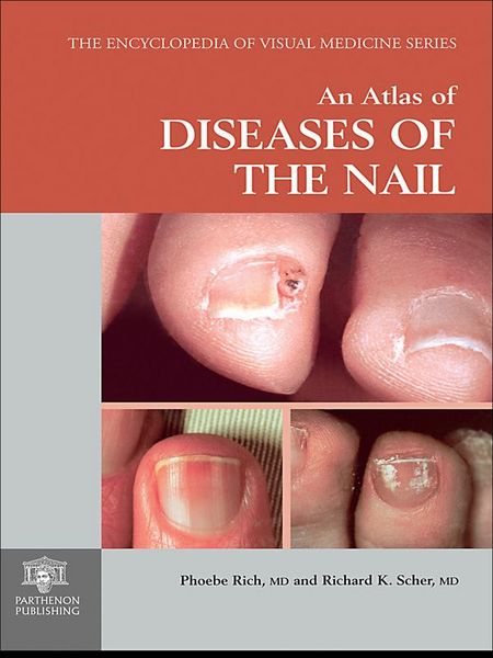 Produktbild: An Atlas of Diseases of the Nail