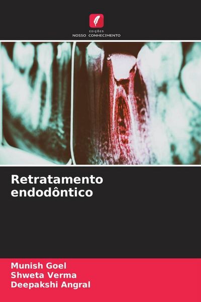 Produktbild: Retratamento endod&ocirc;ntico