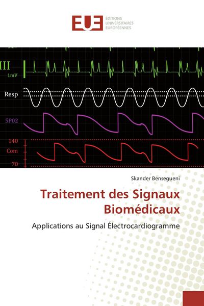 Produktbild: Traitement des Signaux Biom&eacute;dicaux