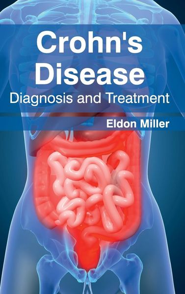 Produktbild: Crohn's Disease