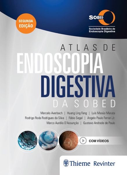 Produktbild: Atlas de Endoscopia Digestiva da SOBED