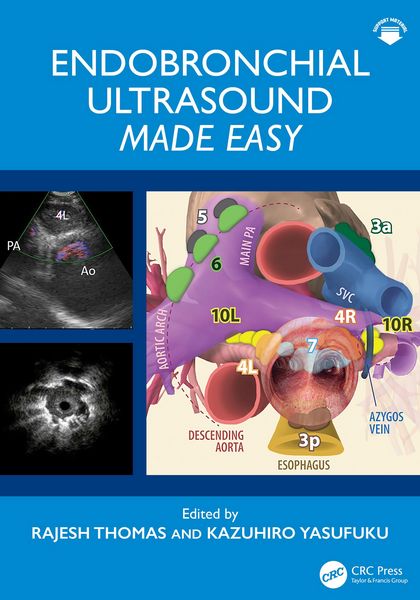 Produktbild: Endobronchial Ultrasound Made Easy