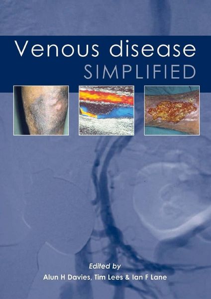 Produktbild: Venous Disease Simplified