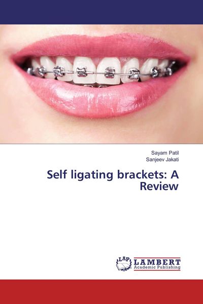 Produktbild: Self ligating brackets: A Review