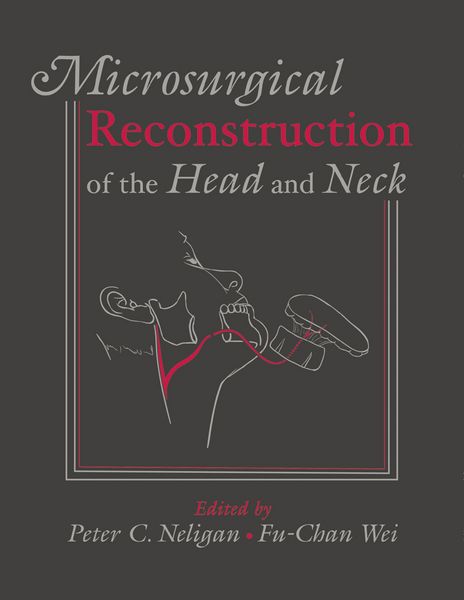 Produktbild: Microsurgical Reconstruction of the Head and Neck