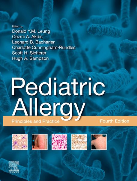 Produktbild: Pediatric Allergy,E-Book
