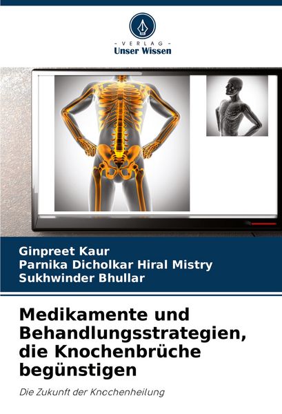 Medikamente und Behandlungsstrategien, die Knochenbrüche begünstigen, Taschenbuch von Ginpreet Kaur , Parnika Dicholkar Hiral Mistry , Sukhwinder