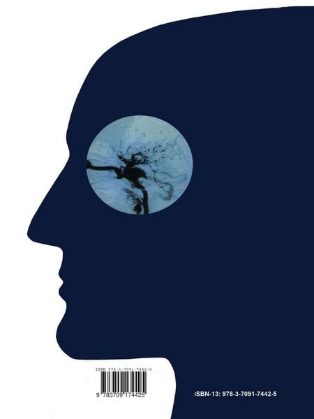Produktbild: Anatomy and Surgery of the Cavernous Sinus
