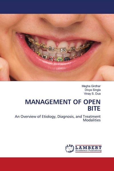 Produktbild: Management Of Open Bite
