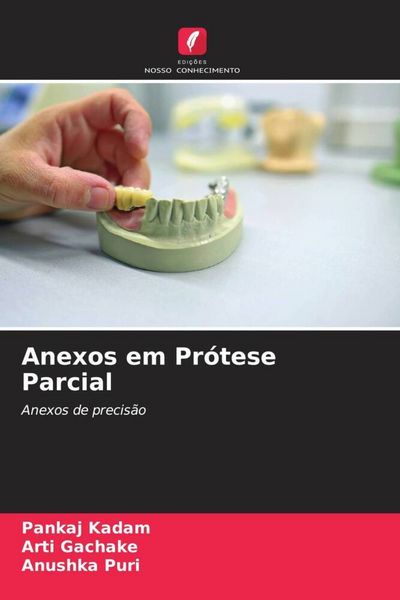 Produktbild: Anexos em Pr&oacute;tese Parcial