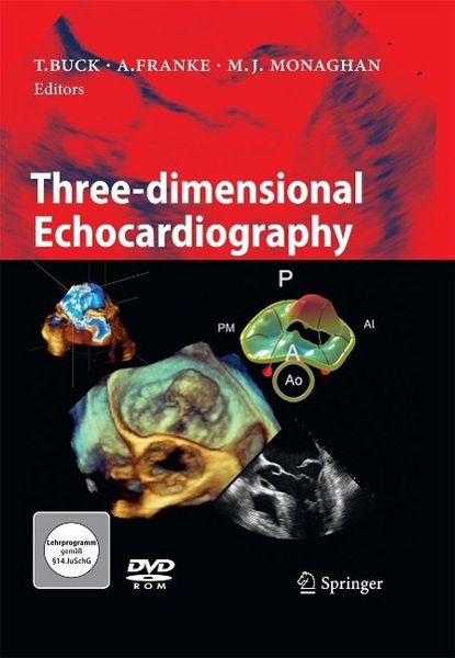 Produktbild: Three-dimensional Echocardiography