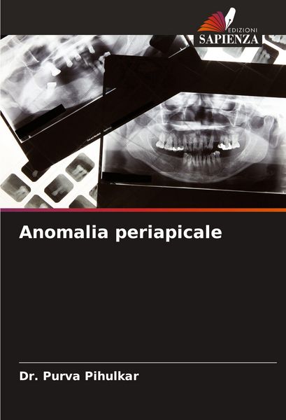 Produktbild: Anomalia periapicale
