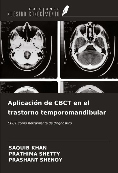 Produktbild: Aplicaci&oacute;n de CBCT en el trastorno temporomandibular