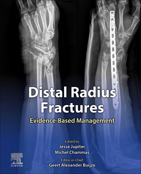 Produktbild: Distal Radius Fractures